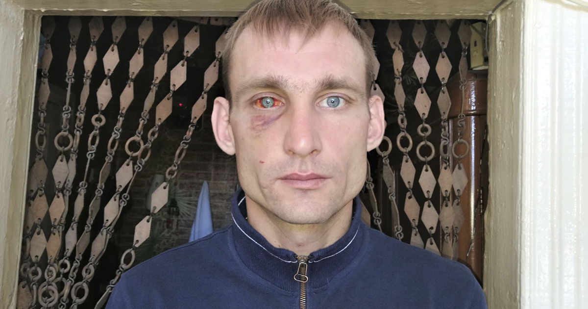 Расслабляющий удар по лицу – не повод возбуждать уголовное дело