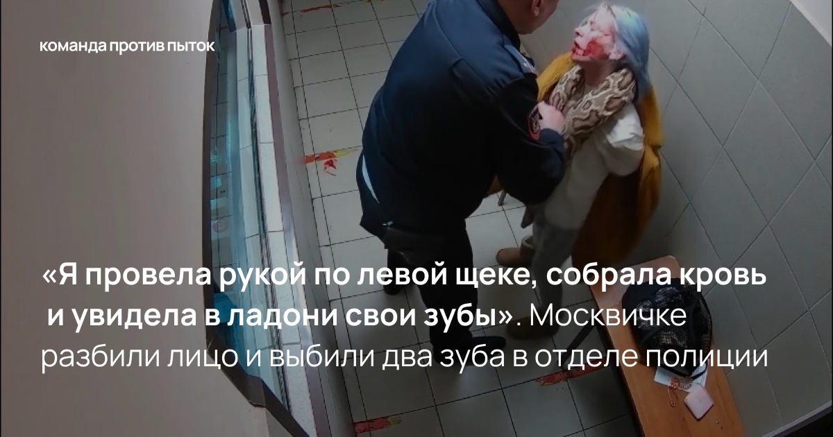 <em>«Я провела рукой по левой щеке, собрала кровь и увидела в ладони свои зубы». </em>Москвичке разбили лицо и выбили два зуба в отделе полиции