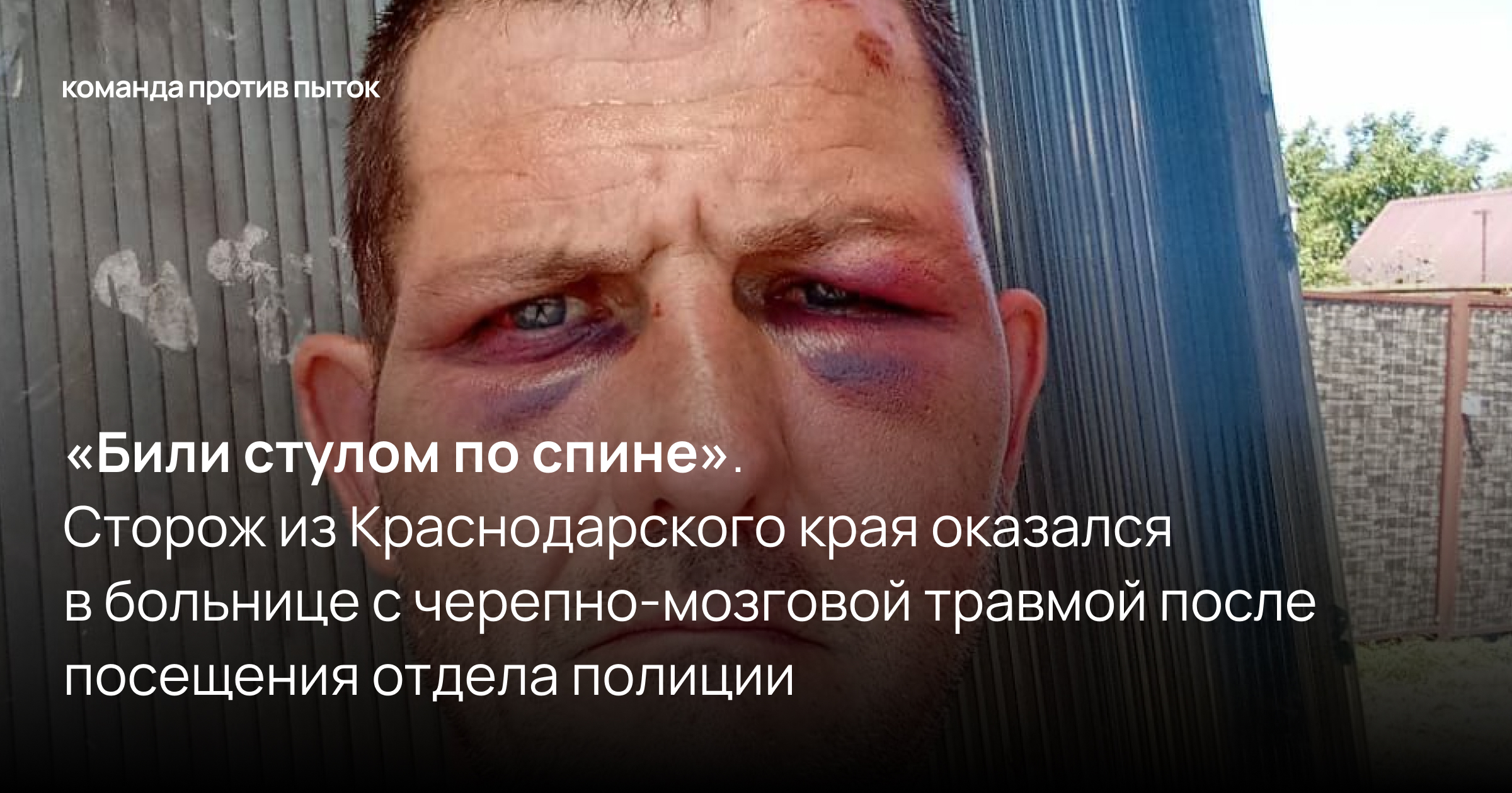 «Били стулом по спине». Сторож из Краснодарского края оказался в больнице с черепно-мозговой травмой после посещения отдела полиции