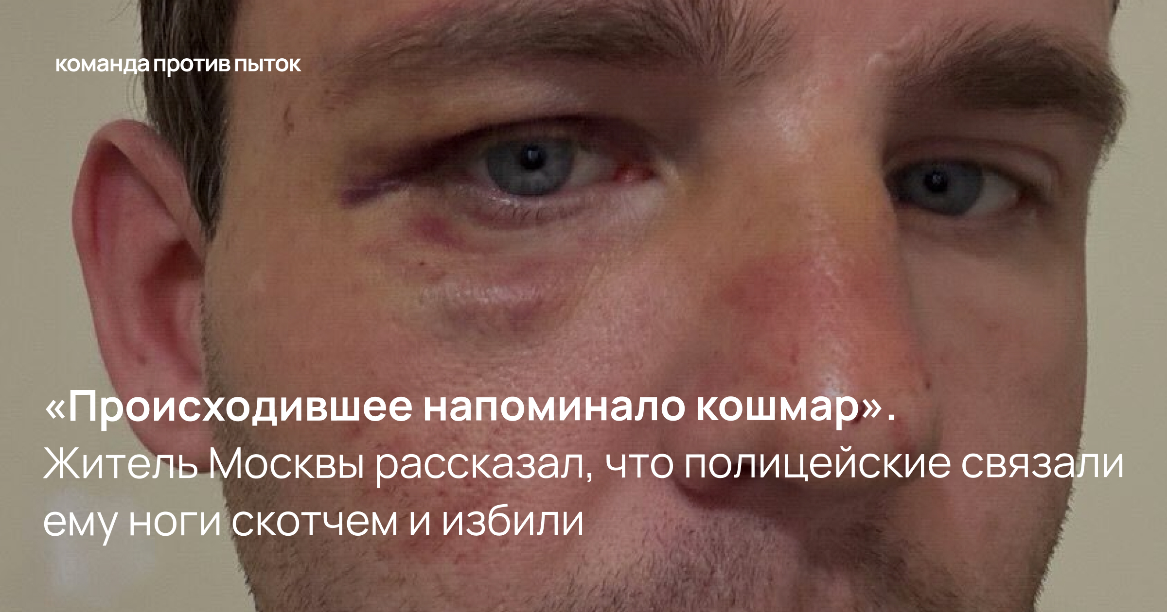 «Происходившее напоминало кошмар». Житель Москвы рассказал, что полицейские связали ему ноги скотчем и избили