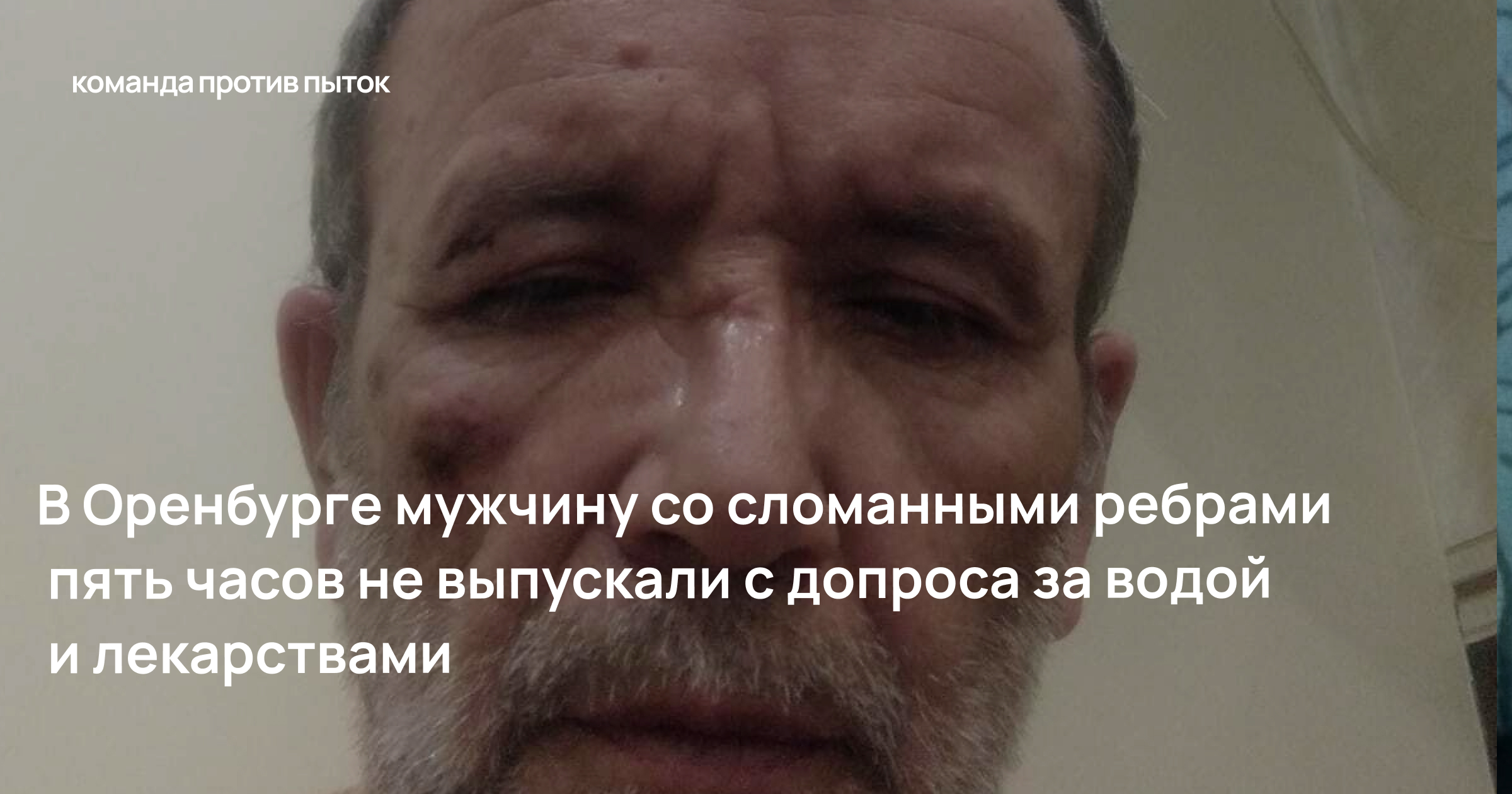 В Оренбурге мужчину со сломанными ребрами пять часов не выпускали с допроса за водой и лекарствами 