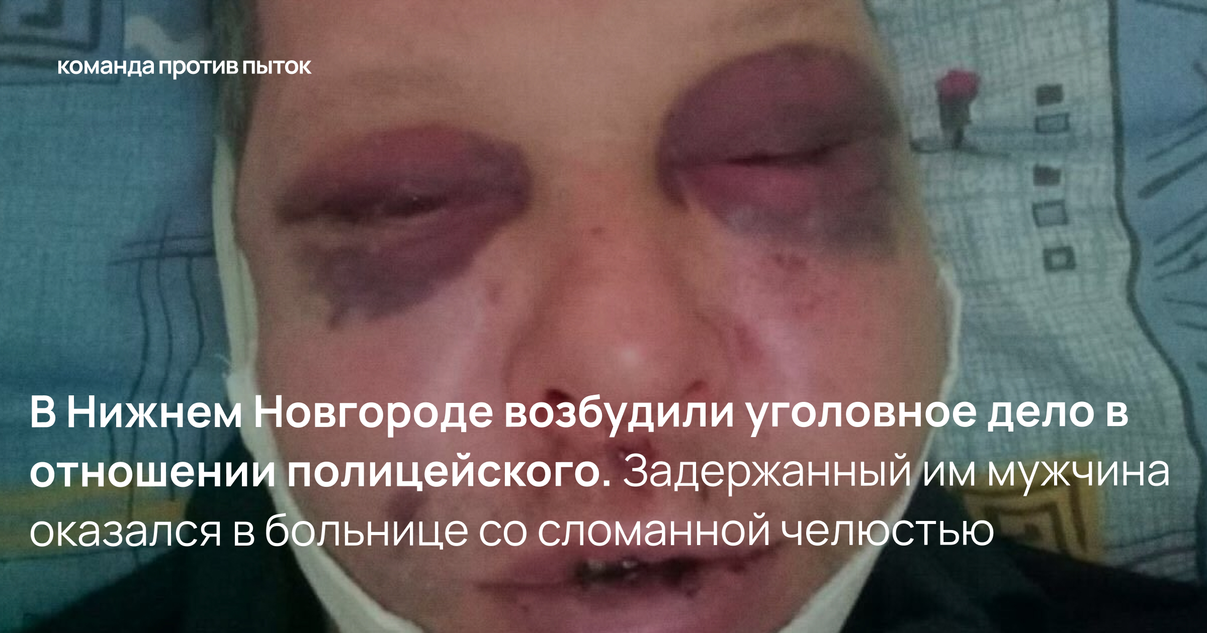 В Нижнем Новгороде возбудили уголовное дело в отношении полицейского. Задержанный им мужчина оказался в больнице со сломанной челюстью 