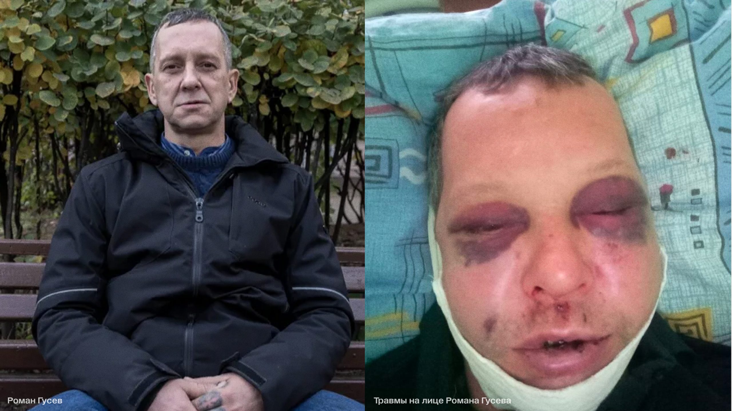 В Нижнем Новгороде прекратили уголовное дело в отношении полицейского. Задержанный им мужчина оказался в больнице со сломанной челюстью